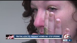 Doctors develop strategy to treat pregnant drug addicts